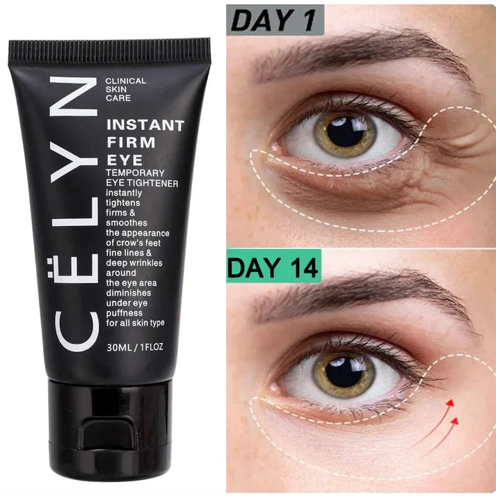 Cëlyn™ - Instant Eye Firmer